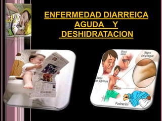 ENFERMEDAD DIARREICA AGUDA    Y DESHIDRATACION 