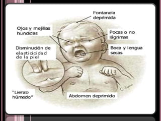 BACTERIASPara que puedan multiplicarse , deben primero adherirse a la mucosa intestinal por fimbrias que se unen a receptores específicos (Vibrio Cholerae y E. Coli: 25% de todas las diarreas).Para evitar ser barridas por los movimientos peristálticos  Por Enterotoxina termolábil ( LT)  o TermoestableHipersecreción de líquidos y electrolitos al Intestino delgado.Actúa similar a la toxina de Vibrio Cholerae: Activa la Adenilato ciclasa Aumento de GMP cíclico.Inhibe absorción de agua, Na, CO3, Cl, K