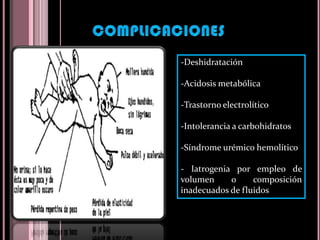        B. Examen físico: Determinar el grado de deshidratación y determinar manejo adecuadoTener la perdida ponderal, que representa la pérdida de líquidos existentes. - DH leve:  pérdida < 5% del peso corporal - DH moderada: pérdida 5-10%  - DH severa: ≥10%