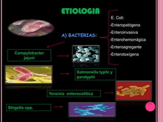 ETIOLOGIA E. Coli:Enteropatógena