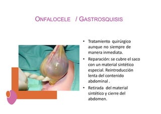 ONFALOCELE / GASTROSQUISIS
• Tratamiento quirúrgico
aunque no siempre de
manera inmediata.
• Reparación: se cubre el saco
con un material sintético
especial. Reintroducción
lenta del contenido
abdominal .
• Retirada del material
sintético y cierre del
abdomen.
 
