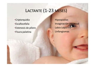 LACTANTE (1-23 MESES)
•Criptorquidia
•Escafocefalia
•Estenosis de píloro
•Fisura palatina
•Hernia inguinal
•Hernia umbilical
•Hidrocefalia
•Hidrocele
•Quiste de cordón
•Himen imperforado
•Luxación congénita de cadera
• Hipospadias
• Invaginación intestinal
• Labio Leporino
• Linfangiomas
• Plagiocefalia
• Sindactilia
• Trigonocefalia
• Tortícolis congénita.
• Pie zambo.
 