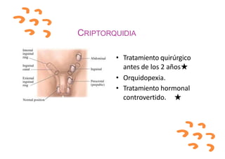CRIPTORQUIDIA
• Tratamiento quirúrgico
antes de los 2 años★
• Orquidopexia.
• Tratamiento hormonal
controvertido. ★
 
