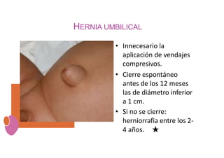 HERNIA UMBILICAL
• Innecesario la
aplicación de vendajes
compresivos.
• Cierre espontáneo
antes de los 12 meses
las de diámetro inferior
a 1 cm.
• Si no se cierre:
herniorrafia entre los 2-
4 años. ★
 