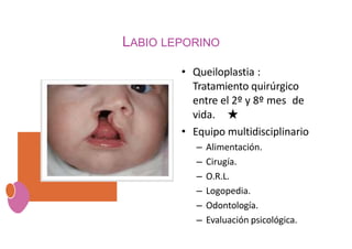 LABIO LEPORINO
• Queiloplastia :
Tratamiento quirúrgico
entre el 2º y 8º mes de
vida. ★
• Equipo multidisciplinario
– Alimentación.
– Cirugía.
– O.R.L.
– Logopedia.
– Odontología.
– Evaluación psicológica.
 