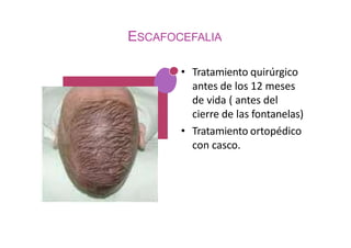 ESCAFOCEFALIA
• Tratamiento quirúrgico
antes de los 12 meses
de vida ( antes del
cierre de las fontanelas)
• Tratamiento ortopédico
con casco.
 