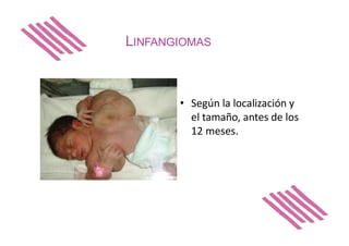 LINFANGIOMAS
• Según la localización y
el tamaño, antes de los
12 meses.
 