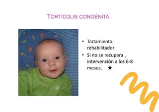 TORTÍCOLIS CONGÉNITA
• Tratamiento
rehabilitador
.
• Si no se recupera ,
intervención a los 6-8
meses. ★
 