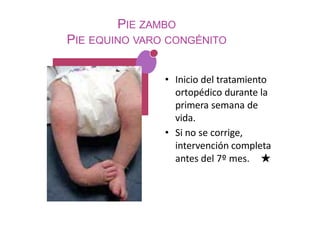 PIE ZAMBO
PIE EQUINO VARO CONGÉNITO
• Inicio del tratamiento
ortopédico durante la
primera semana de
vida.
• Si no se corrige,
intervención completa
antes del 7º mes. ★
 