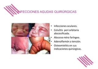 INFECCIONES AGUDAS QUIRÚRGICAS
• Infecciones oculares.
• Celulitis peri orbitaria
abscesificada.
• Absceso retro faríngeo.
• Adenoflemón a tensión.
• Osteomielitis en sus
indicaciones quirúrgicas.
 