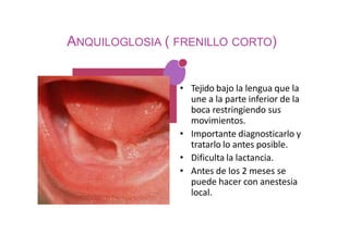 ANQUILOGLOSIA ( FRENILLO CORTO)
• Tejido bajo la lengua que la
une a la parte inferior de la
boca restringiendo sus
movimientos.
• Importante diagnosticarlo y
tratarlo lo antes posible.
• Dificulta la lactancia.
• Antes de los 2 meses se
puede hacer con anestesia
local.
 