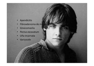 Adolescente (13-18 años)
• Apendicitis
• Fibroadenoma de mama
• Ginecomastia
• Pectus excavatum
• Uña incarnata
• Varicocele
 