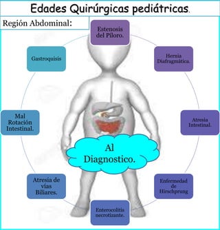 Región Abdominal:
Edades Quirúrgicas pediátricas.
Estenosis
del Píloro.
Hernia
Diafragmática.
Atresia
Intestinal.
Enfermedad
de
Hirschprung
Enterocolitis
necrotizante.
Atresia de
vías
Biliares.
Mal
Rotación
Intestinal.
Gastroquisis
Al
Diagnostico.
 