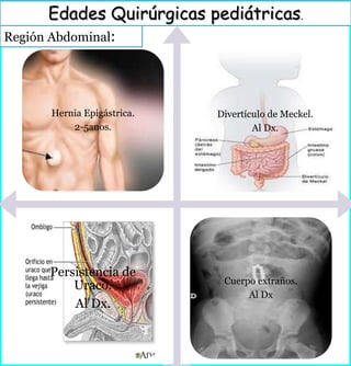 Región Abdominal:
Edades Quirúrgicas pediátricas.
Hernia Epigástrica.
2-5anos.
Divertículo de Meckel.
Al Dx.
Persistencia de
Uraco.
Al Dx.
Cuerpo extraños.
Al Dx
 