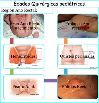 Región Ano Rectal:
Edades Quirúrgicas pediátricas.
Atresia Ano Rectal:
al nacimiento.
Hemorroides.
Fisura Anal. Pólipos Rectales.
Quistes perianales.
Prolapso Ano
rectal.
 