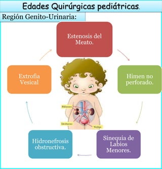 Región Genito-Urinaria:
Edades Quirúrgicas pediátricas.
Estenosis del
Meato.
Himen no
perforado.
Sinequia de
Labios
Menores.
Hidronefrosis
obstructiva.
Extrofia
Vesical
 