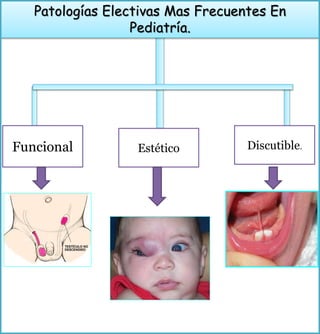 Patologías Electivas Mas Frecuentes En
Pediatría.
Funcional Estético Discutible.
 