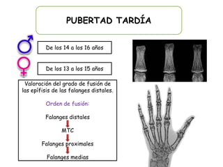 PUBERTAD TARDÍA


         De los 14 a los 16 años


         De los 13 a los 15 años

 Valoración del grado de fusión de
las epífisis de las falanges distales.

         Orden de fusión:

         Falanges distales

                MTC

        Falanges proximales

          Falanges medias
 