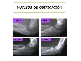 NUCLEOS DE OSIFICACIÓN



 2 AÑOS        5 AÑOS




5- 6 AÑOS      12 AÑOS
 