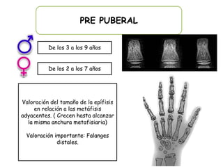 PRE PUBERAL


          De los 3 a los 9 años


          De los 2 a los 7 años




Valoración del tamaño de la epífisis
     en relación a las metáfisis
adyacentes. ( Crecen hasta alcanzar
  la misma anchura metafisiaria)

  Valoración importante: Falanges
              distales.
 