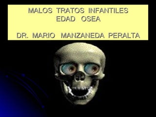 MALOS TRATOS INFANTILESMALOS TRATOS INFANTILES
EDAD OSEAEDAD OSEA
DR. MARIO MANZANEDA PERALTADR. MARIO MANZANEDA PERALTA
 