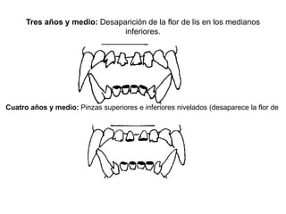 Tres años y medio: Desaparición de la flor de lis en los medianos
inferiores.
Cuatro años y medio: Pinzas superiores e inferiores nivelados (desaparece la flor de
 