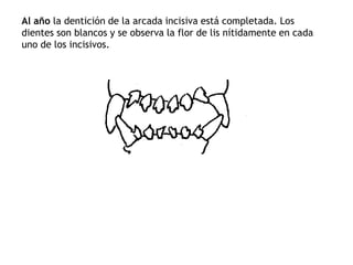 Al año la dentición de la arcada incisiva está completada. Los
dientes son blancos y se observa la flor de lis nítidamente en cada
uno de los incisivos.
 