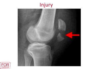 Injury
 