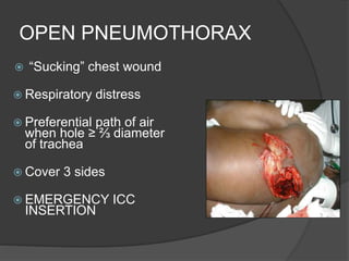 OPEN PNEUMOTHORAX
 “Sucking” chest wound
 Respiratory distress
 Preferential path of air
when hole ≥ ⅔ diameter
of trachea
 Cover 3 sides
 EMERGENCY ICC
INSERTION
 