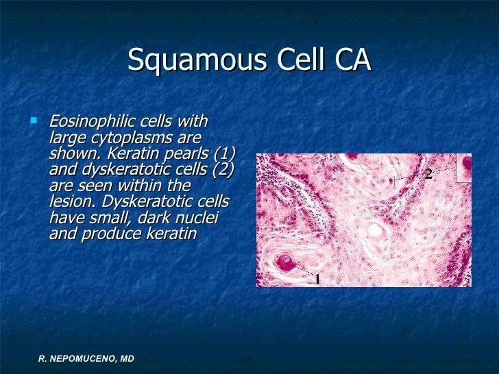 Ed&cornea lecture fatima