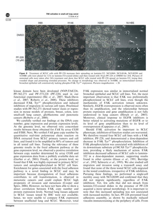 kinase domain have been developed (NVP-TAE226,
PF-562,271 and PF-573,228 (PF-228) used in our
functional experiments) (Shi et al., 2007; Slack-Davis
et al., 2007; Roberts et al., 2008). These inhibitors
decreased FAK Tyr397
phosphorylation and induced
inhibition of migration in various cell types. Preclinical
studies with PF-562,271 showed tumor stasis or regres-
sion in mouse models of prostate, breast, colon, non-
small-cell lung cancer, glioblastoma and pancreatic
cancers (Roberts et al., 2008).
We carefully veriﬁed our ﬁndings at the DNA copy
number, gene expression and protein expression levels.
At the genomic level, we observed very concordant
results between those obtained for FAK by array CGH
and FISH. Next, We veriﬁed FAK gene copy number by
quantitative real-time polymerase chain reaction on
DNA extracted from SCLC primary tumors and cell
lines, and found it to be ampliﬁed in 80% of tumors and
in all tested cell lines. Testing the relevance of these
genomic results in the focal adhesion pathway at the
gene expression level, we observed a positive correlation
between copy number determined by array CGH and
gene expression data from a publicly available data set
(Garber et al., 2001). Finally, at the protein level, we
found that FAK was highly expressed in primary SCLC
tumors and autophosphorylated in SCLC cell lines.
Enrichment for genes associated with the focal adhesion
pathway is a novel ﬁnding in SCLC and may be
important because dysregulation of focal adhesions
contributes to cell transformation, is observed in
metastatic cancers and could explain SCLC high
propensity of invasion and metastasis (Cooper and
Spiro, 2006). However, we have not been able to show a
direct correlation between FAK copy number and
protein expression levels. Normal lung tissues adjacent
to SCLC tissues tested by IHC were not available;
hence, we were unable to compare FAK expression
between unaffected lung and SCLC. Moreover, total
FAK expression was similar in immortalized normal
bronchial epithelial and SCLC cell lines. Yet, the most
important observation is that FAK was preferentially
phosphorylated in SCLC cell lines, even though the
mechanisms of FAK activation remain unknown.
Similarly, EGFR overexpression is observed more often
than its ampliﬁcation, and the relationship between
protein expression and gene ampliﬁcation is not fully
understood in lung cancers (Hirsch et al., 2003).
Moreover, clinical response to EGFR inhibitors is
better related to activating mutations of EGFR or to
its level of gene ampliﬁcation than to its level of
overexpression (Cappuzzo et al., 2005).
Should FAK activation be important in SCLC
phenotype, inhibition-of-function studies are warranted.
We therefore treated four SCLC cell lines with a FAK
inhibitor, PF-228, and demonstrated a dose-dependent
decrease in FAK Tyr397
phosphorylation. Inhibition of
FAK phosphorylation was associated with inhibition of
its downstream substrate p130CAS Tyr165
phosphoryla-
tion, providing a likely mechanism of action. FAK
inhibition decreased adhesion of SCLC cells to laminin-
332 in a dose-dependent manner, supporting results
found in other systems (Guan et al., 1991; Burridge
et al., 1992; Schwartz et al., 1995). We also studied cell
migration and invasion using a transwell assay and
found that none of the three tested SCLC cells migrated
in the tested conditions, irrespective of FAK inhibition.
Pursuing these ﬁndings, we performed a single-cell
motility assay with NCI-H209 and conﬁrmed that they
did not migrate signiﬁcantly, regardless of FAK
inhibition. Yet, few cells that did not detach from
laminin-332-coated dishes in the presence of PF-228
acquired a more spread morphology. It is important to
note that this increased spreading was not associated
with increased motility. In fact, PF-228 prevented focal
adhesions assembly, as shown by markedly reduced
vinculin immunostaining at the periphery of cells. From
Figure 8 Treatment of SCLC cells with PF-228 increases their spreading on laminin-332. NCI-H69, NCI-H146, NCI-H209 and
16-HBE cells were plated for 12 h on laminin-332-coated dishes and then treated with 10 mM PF-228 or DMSO for 24 h. Pictures of
unstained cells were taken after 24 h treatment and show that SCLC cells treated with PF-228 spread on laminin-332, losing their
rounded shape and presenting extended processes. No change in morphology was observed in 16-HBE, an immortalized normal
bronchial epithelial cell constitutively lacking phospho-FAK Tyr397
expression. Pictures magniﬁcation: Â 20.
FAK activation in small-cell lung cancer
S Ocak et al
6338
Oncogene
 