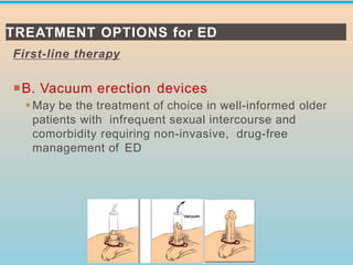 First-line therapy
B. Vacuum erection devices
▪May be the treatment of choice in well-informed older
patients with infrequent sexual intercourse and
comorbidity requiring non-invasive, drug-free
management of ED
TREATMENT OPTIONS for ED
 
