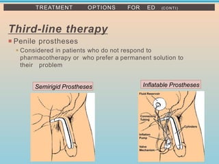Third-line therapy
 Penile prostheses
▪ Considered in patients who do not respond to
pharmacotherapy or who prefer a permanent solution to
their problem
TREATMENT OPTIONS FOR ED (CONTI)
Semirigid Prostheses Inflatable Prostheses
 