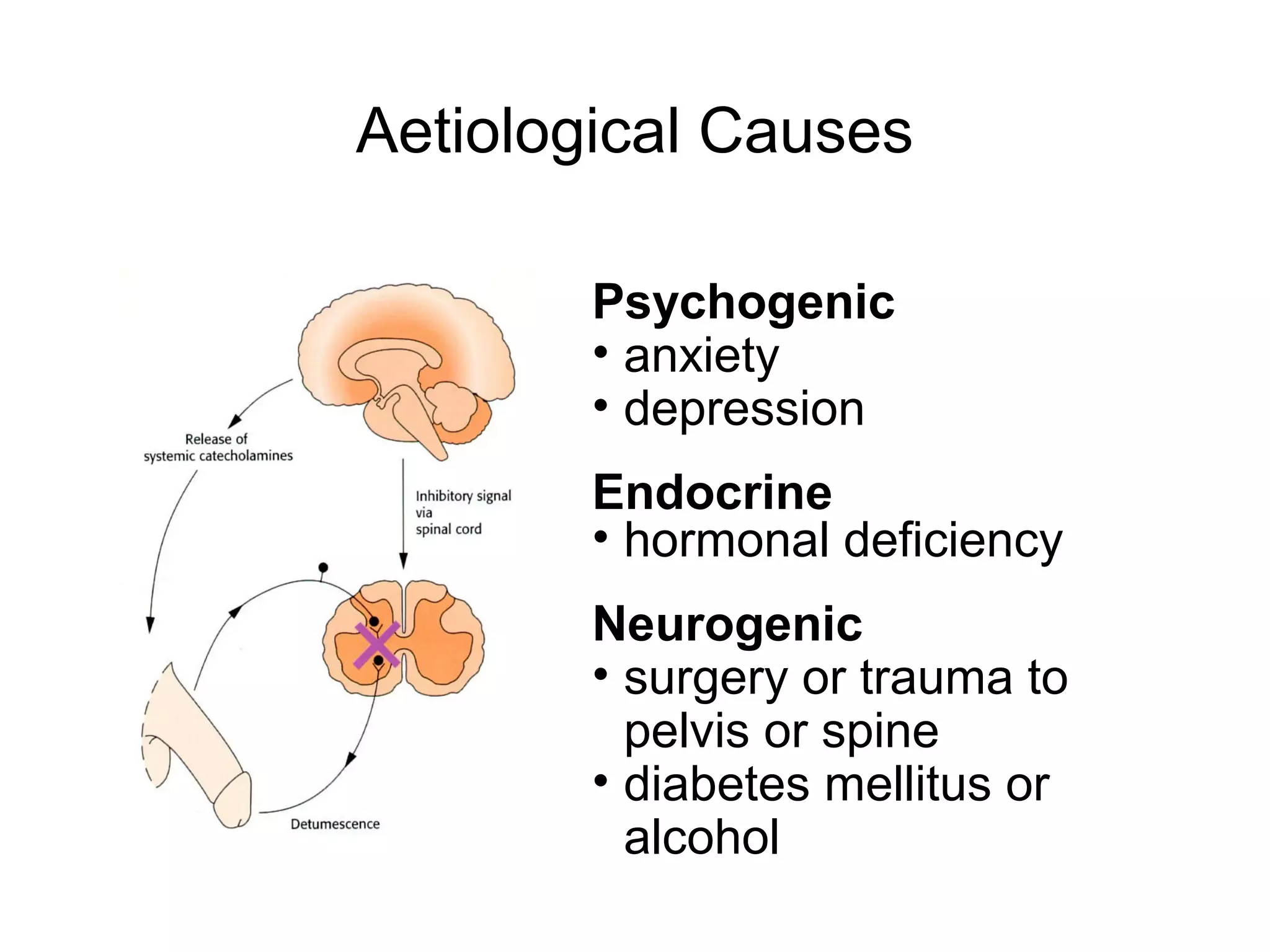 Aetiological Causes
Psychogenic
• anxiety
• depression
Endocrine
• hormonal deficiency
Neurogenic
• surgery or trauma to
pelvis or spine
• diabetes mellitus or
alcohol
 