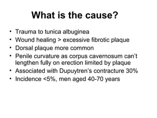 What is the cause?
• Trauma to tunica albuginea
• Wound healing > excessive fibrotic plaque
• Dorsal plaque more common
• Penile curvature as corpus cavernosum can’t
lengthen fully on erection limited by plaque
• Associated with Dupuytren’s contracture 30%
• Incidence <5%, men aged 40-70 years
 
