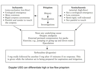 Doppler USG can differentiate high or low flow priaprism
 