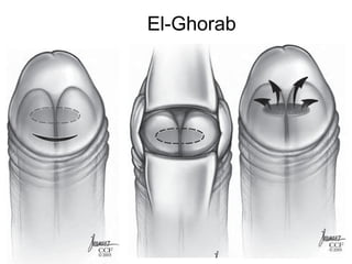 El-Ghorab
 