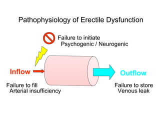 Pathophysiology of Erectile Dysfunction
Inflow Outflow
Failure to initiate
Psychogenic / Neurogenic
Failure to store
Venous leak
Failure to fill
Arterial insufficiency
 