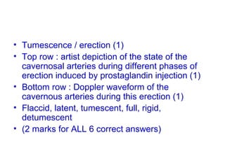 • Tumescence / erection (1)
• Top row : artist depiction of the state of the
cavernosal arteries during different phases of
erection induced by prostaglandin injection (1)
• Bottom row : Doppler waveform of the
cavernous arteries during this erection (1)
• Flaccid, latent, tumescent, full, rigid,
detumescent
• (2 marks for ALL 6 correct answers)
 