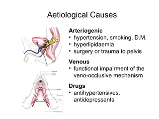 Aetiological Causes
Arteriogenic
• hypertension, smoking, D.M.
• hyperlipidaemia
• surgery or trauma to pelvis
Venous
• functional impairment of the
veno-occlusive mechanism
Drugs
• antihypertensives,
antidepressants
 