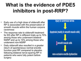 What is the evidence of PDE5
inhibitors in post-RRP?
• Early use of a high dose of sildenafil after
RP is associated with the preservation of
smooth muscle within the human corpora
cavernosa
• The response rate to sildenafil treatment
for ED after RP in different trials up to 70%
among those who underwent bilateral
NSRP and up to 15% among those who
underwent non-NSRP
• Daily sildenafil also resulted in a greater
return of spontaneous normal erectile
function post RP compared to placebo
following bilateral nerve-sparing RP in
patients who were fully potent before
surgery
 