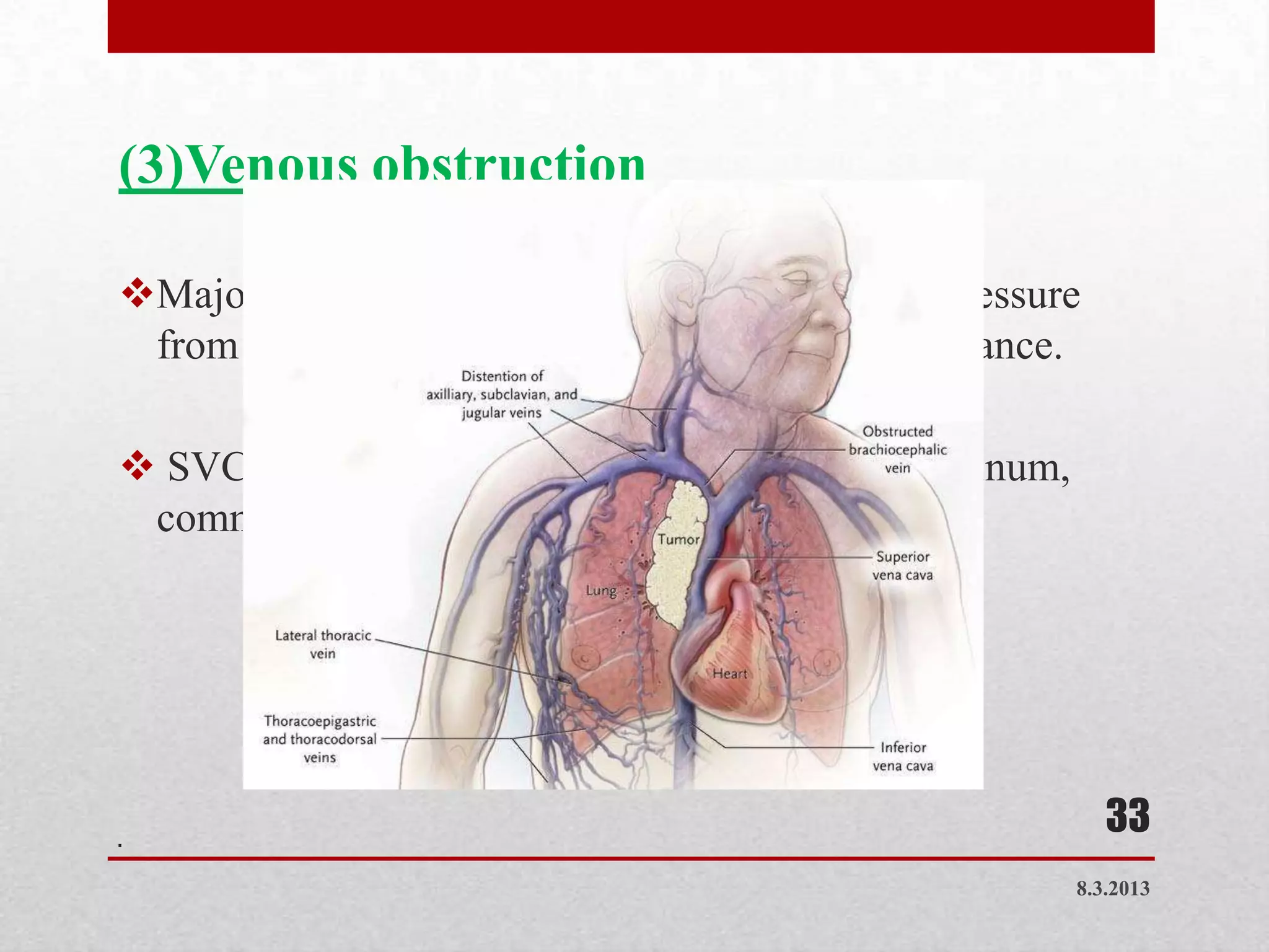 (3)Venous obstruction

Major cause - deep vein thrombosis, external pressure
 from a tumor or pregnancy, or valvular incompitance.

 SVCO is caused by a tumor in superior mediastinum,
 commonly lung cancer.




.
                                                          33
                                                       8.3.2013
 