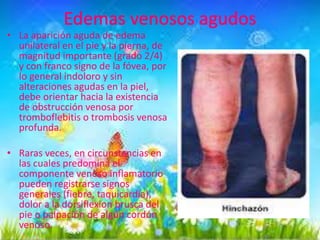 • La aparición aguda de edema
unilateral en el pie y la pierna, de
magnitud importante (grado 2/4)
y con franco signo de la fóvea, por
lo general indoloro y sin
alteraciones agudas en la piel,
debe orientar hacia la existencia
de obstrucción venosa por
tromboflebitis o trombosis venosa
profunda.
• Raras veces, en circunstancias en
las cuales predomina el
componente venoso inflamatorio
pueden registrarse signos
generales (fiebre, taquicardia),
dolor a la dorsiflexion brusca del
pie o palpación de algún cordón
venoso.

 