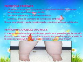 • Los edemas de patogenia primaria es la hipertensión venosa. Aumenta en
horas diurnas y en el transcurso del día.
• Son fríos e indoloros y en ocasiones cianóticos.
• Cuando es grave: se acompaña de insuficiencia cardiaca.
Disnea, ingurgitación yugular, hepatomegalia, estertores pulmonares bibasales.

HEPATOPATIAS CRONICAS EN CIRROSIS.
El edema bilateral de miembros inferiores puede estar precedido por la aparición
de ascitis lo cual puede agravar, primero acaece por hipoalbuminemia a través de
la acción comprensiva del liquido peritoneal sobre la vena cava inferior.

 
