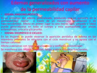 Edema | PPTX