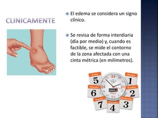 Edema | PPTX