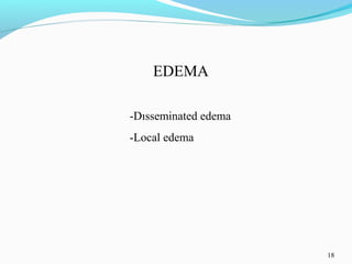 18
EDEMA
-Dısseminated edema
-Local edema
 