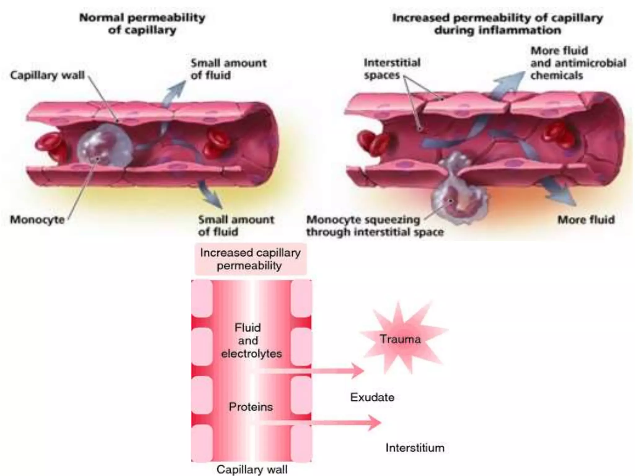 Edema | PPTX