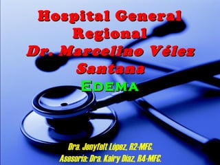 Hospital GeneralHospital General
RegionalRegional
Dr.Dr. MarcelinoMarcelino VVéélezlez
SantanaSantana
EdemaEdema
Dra. Jenyfelt López, R2-MFC.
Asesoría: Dra. Kairy Díaz, R4-MFC.
 
