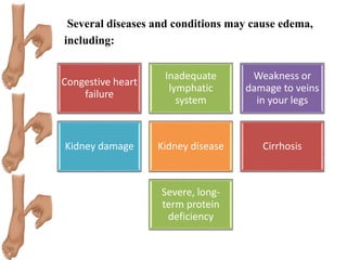 Several diseases and conditions may cause edema,
including:
Congestive heart
failure
Inadequate
lymphatic
system
Weakness or
damage to veins
in your legs
Kidney damage Kidney disease Cirrhosis
Severe, long-
term protein
deficiency
 